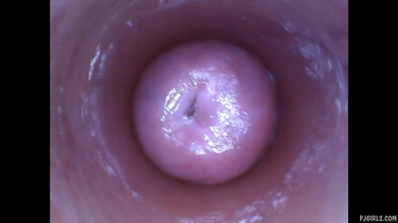 best of Endoscope mouth