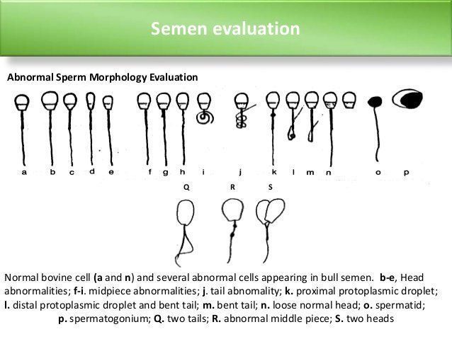 best of Get Abnormal better sperm