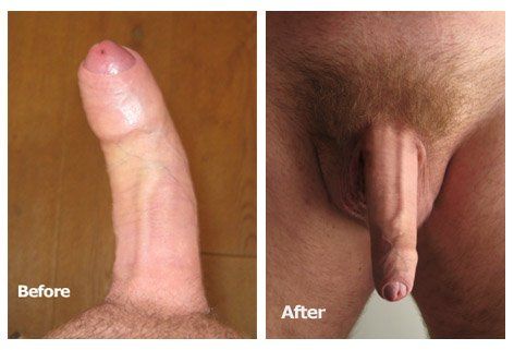 Congo reccomend Downwards curved dick porn