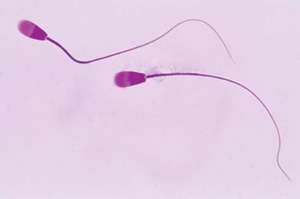 Magnification of human sperm