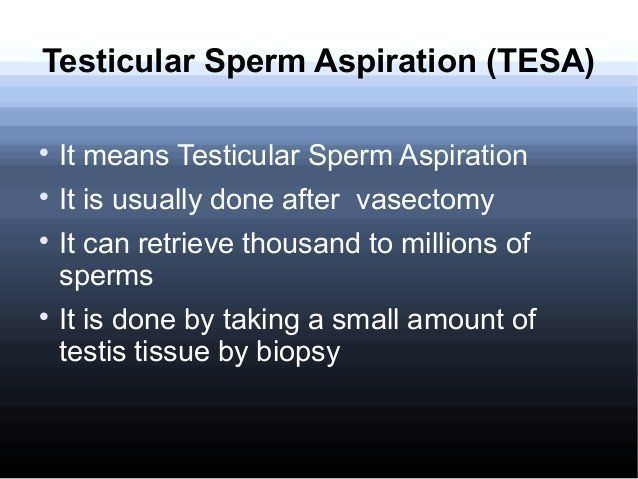 Vasectomy retrieval of sperm